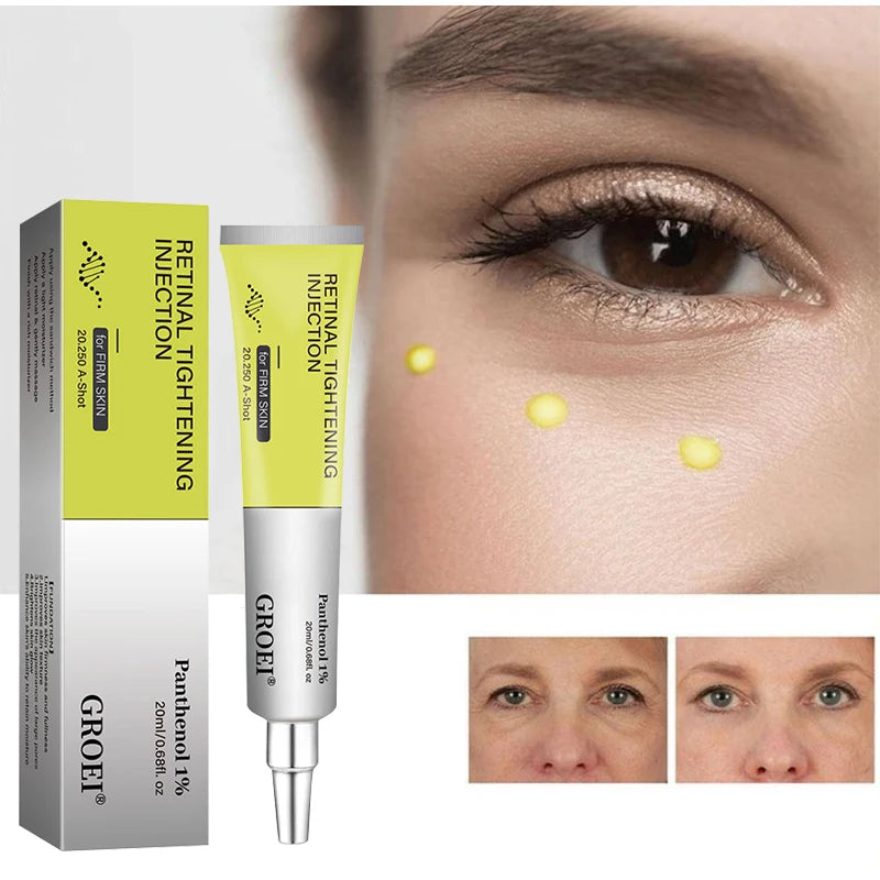 Retinol Moisturizing Eye Cream Reduces Dark Circles Brighten Skin Firms Skin Deeply Moisturizes Korean Brand New Facial Skincare