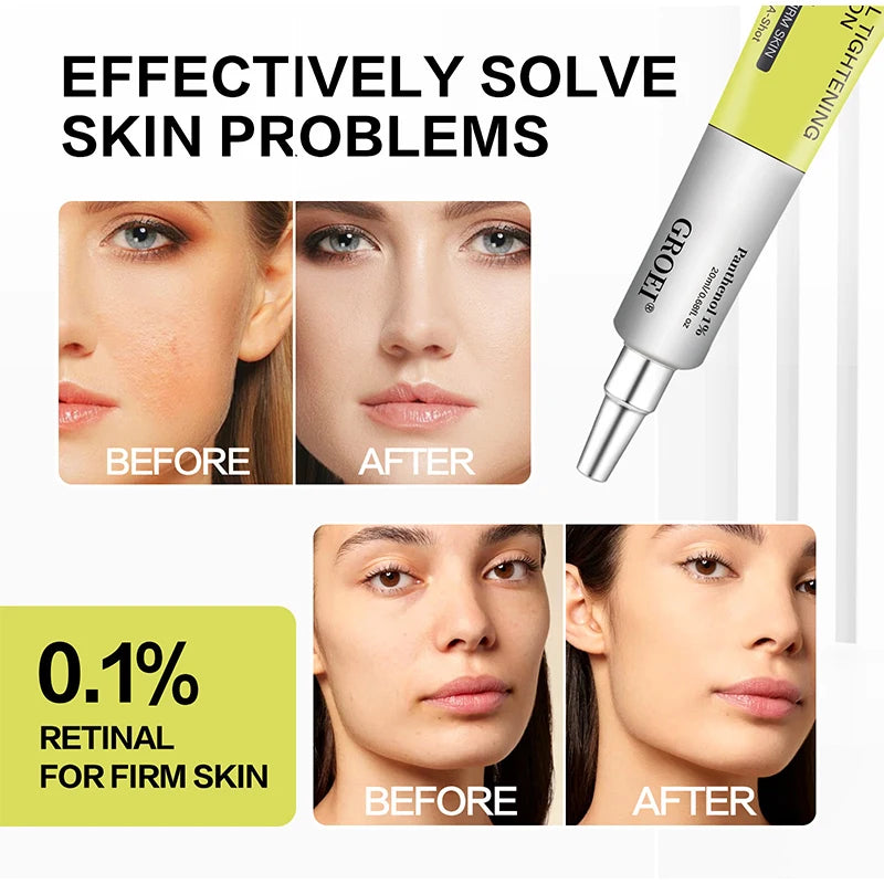 Retinol Moisturizing Eye Cream Reduces Dark Circles Brighten Skin Firms Skin Deeply Moisturizes Korean Brand New Facial Skincare