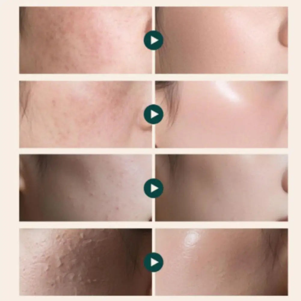 Korean Dr. REJUALL SALMON PDRN FOR SENSITIVE SKIN Cream Enhance Skin Elasticity Reduce Fine Lines And Deeply Hydrate